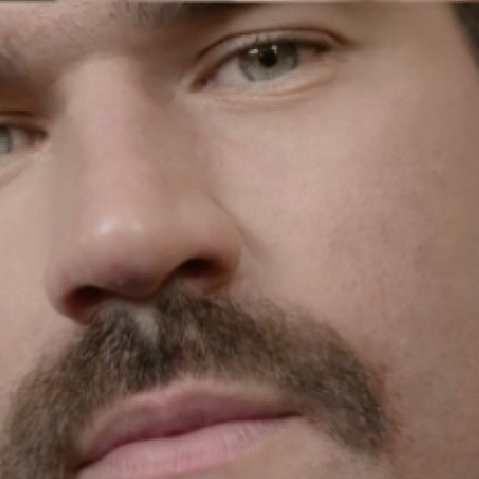O bigode de Alisson em detalhe